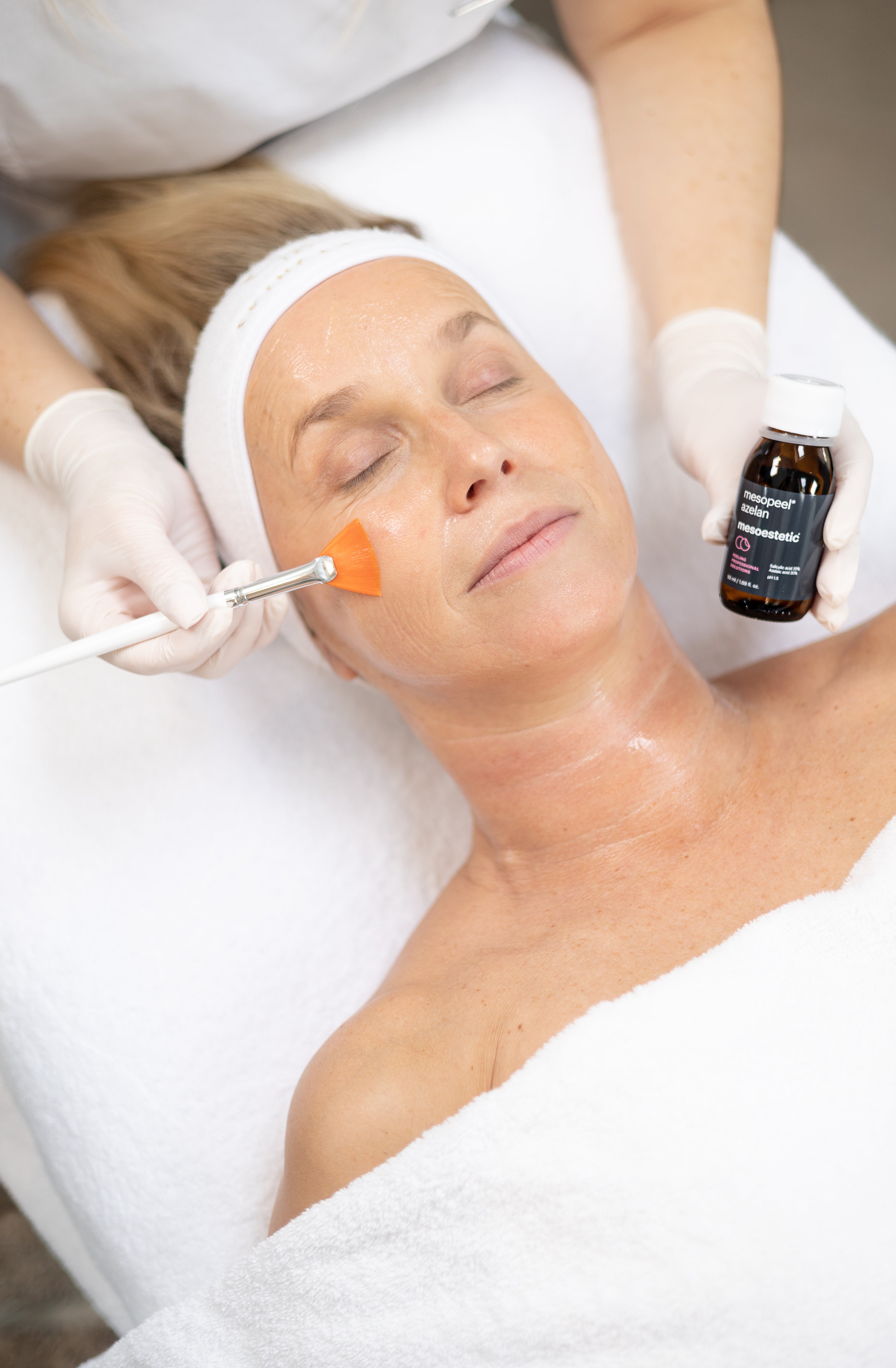 Roodheid/rosacea